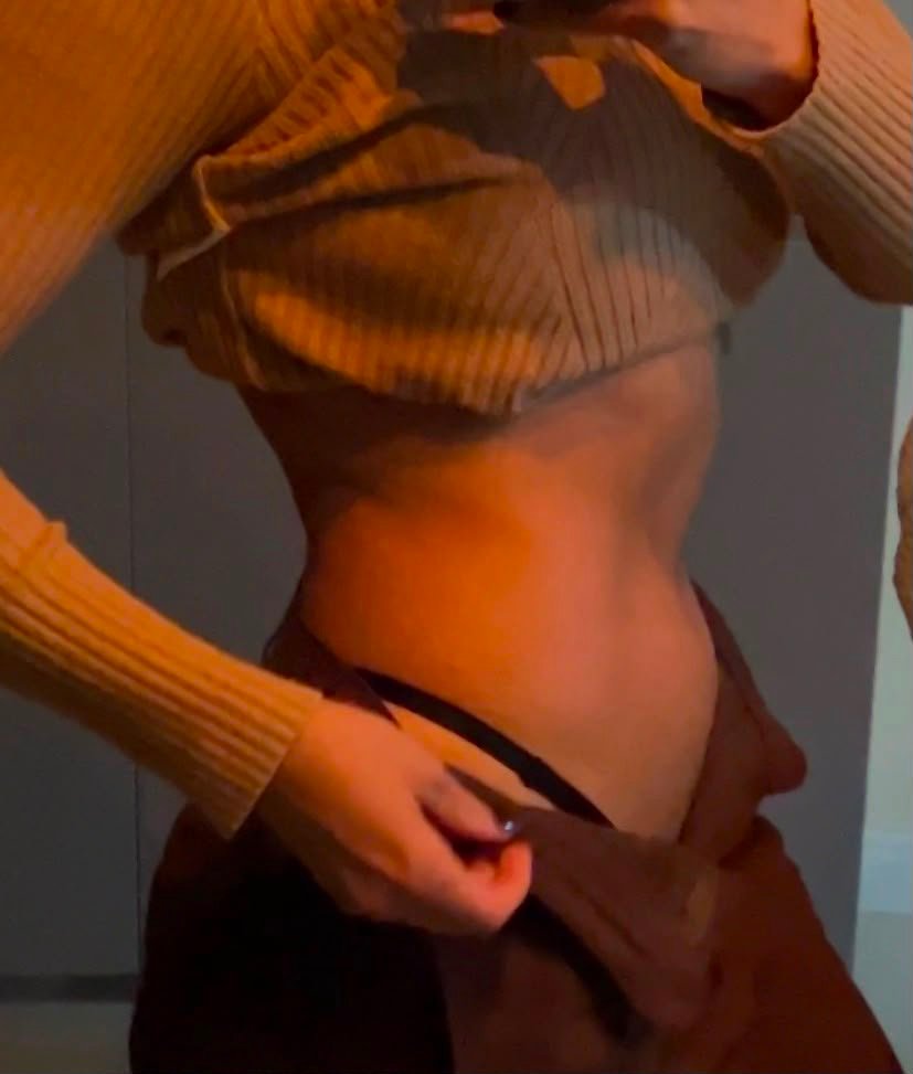 Alene Xavier antes do My Lipo
