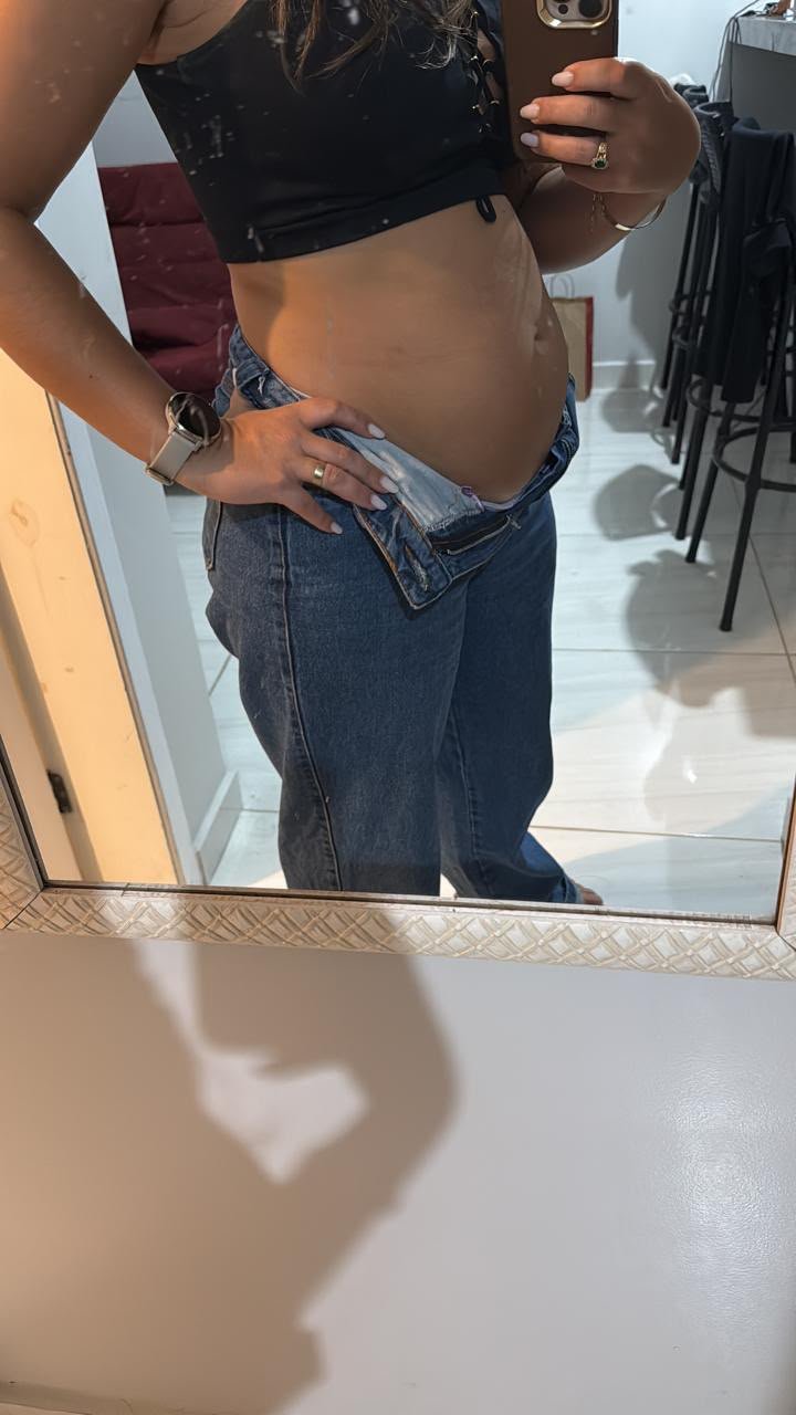 Tatiane Vargas antes do My Lipo