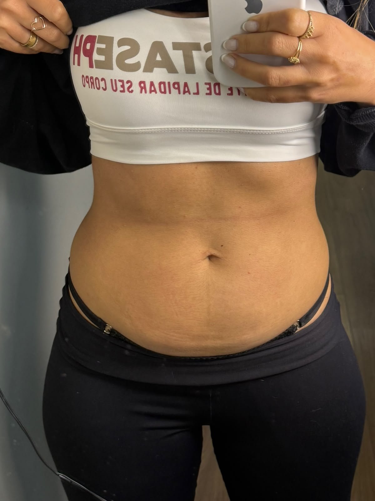 Cliente antes do My Lipo